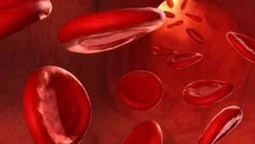 Kansızlık Sinir Yapar mı?