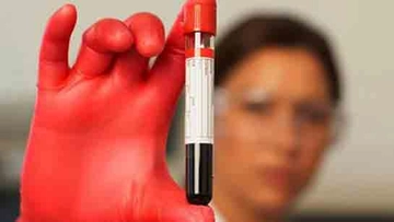 Kansızlık Testi Nedir ve Nasıl Yapılır?